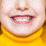 malocclusione pediatrica