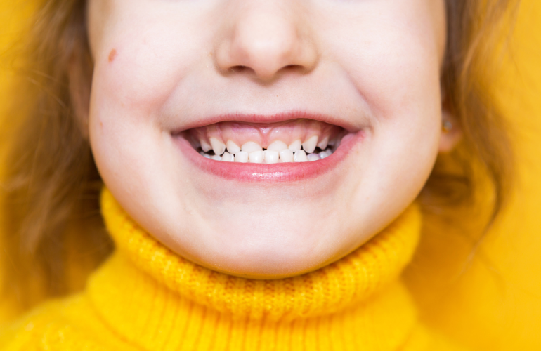 malocclusione pediatrica