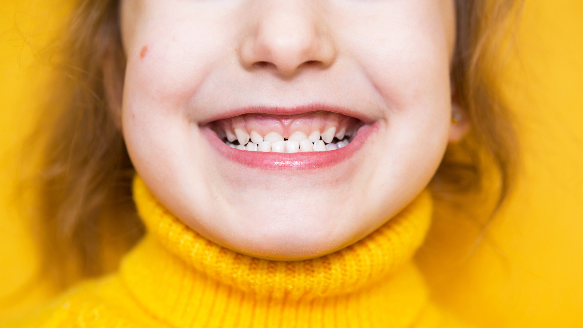 malocclusione pediatrica